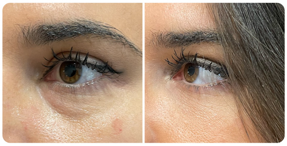 ayd-ojeras-9